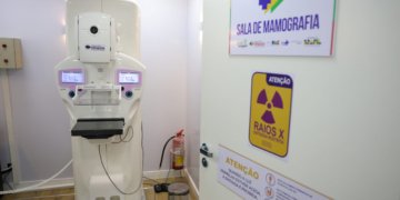 Cirurgias plásticas mamárias pelo SUS avançam 54% na última década com foco em reparação