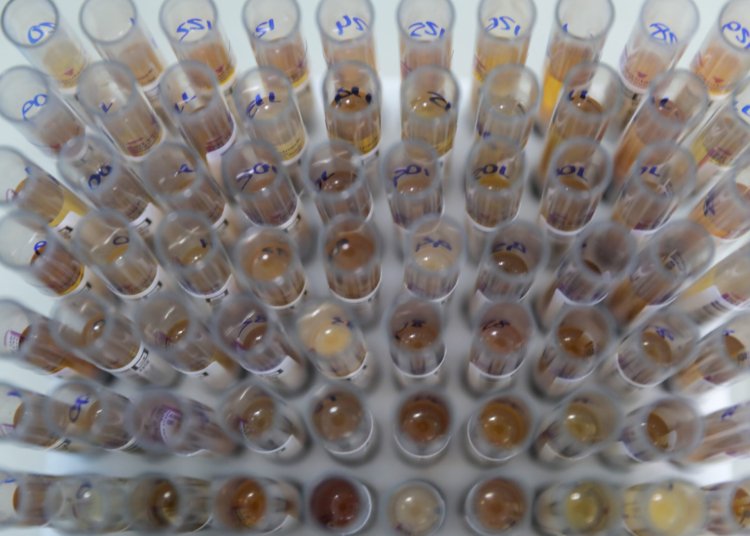 Malária registra menor nível de casos em 47 anos no Brasil após adoção de dose única no SUS