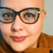 Alopecia areata mobiliza pacientes entre a superação e debates sobre direitos legais