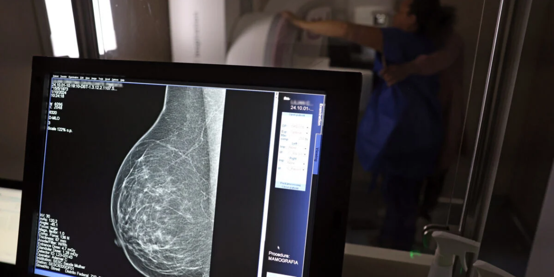 Mamografia digital terá cobertura obrigatória em planos de saúde sem restrição de idade
