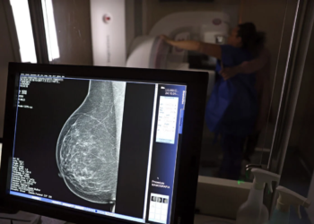 Mamografia digital terá cobertura obrigatória em planos de saúde sem restrição de idade