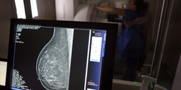 Mamografia digital terá cobertura obrigatória em planos de saúde sem restrição de idade