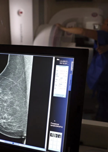 Mamografia digital terá cobertura obrigatória em planos de saúde sem restrição de idade