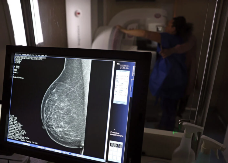 Mamografia digital terá cobertura obrigatória em planos de saúde sem restrição de idade