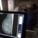 Mamografia digital terá cobertura obrigatória em planos de saúde sem restrição de idade